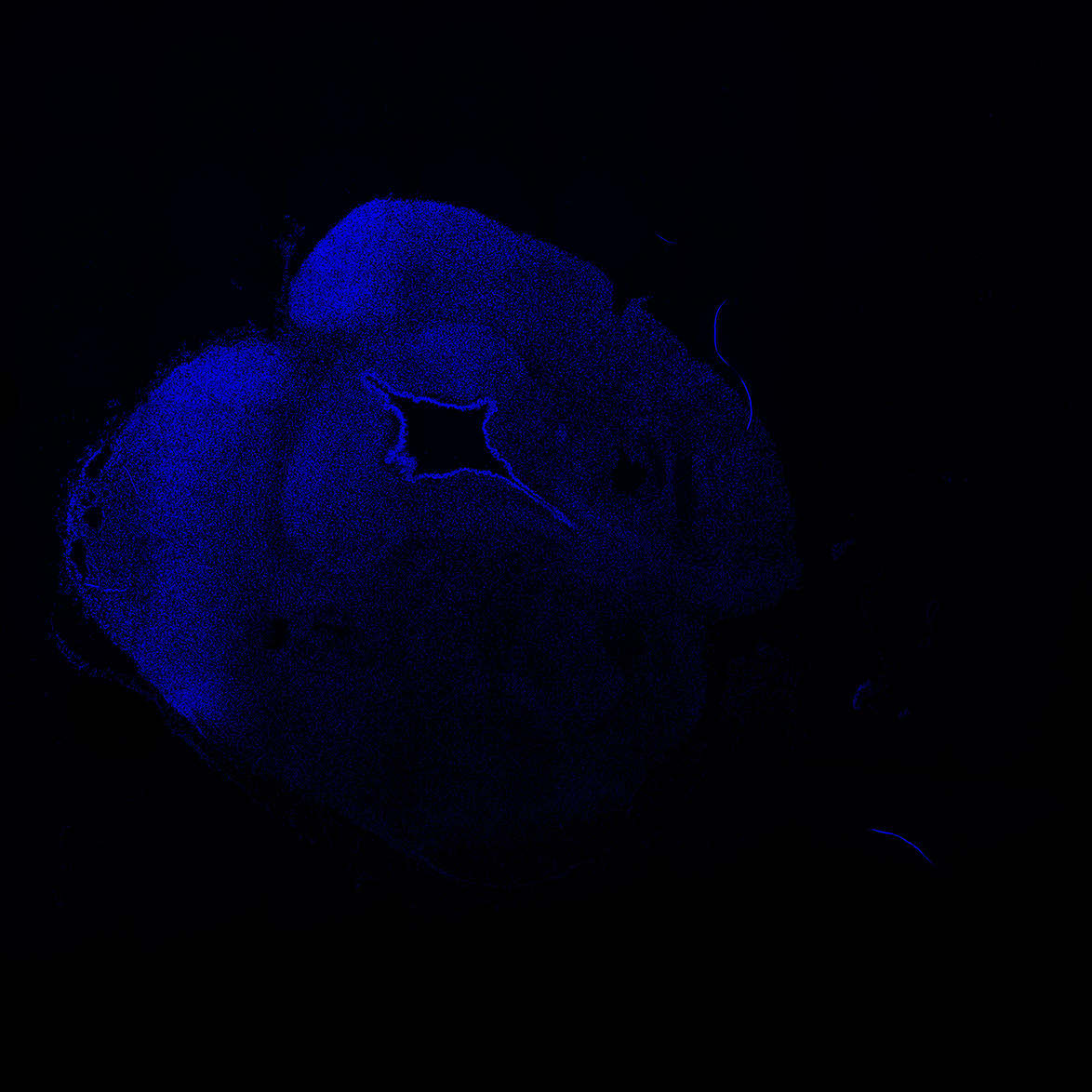 Human foetal midbrain